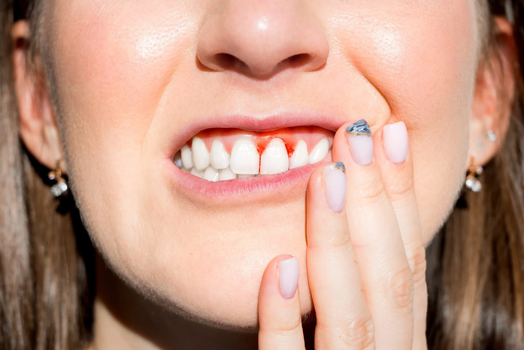 4 Risk Factors for Gum Disease